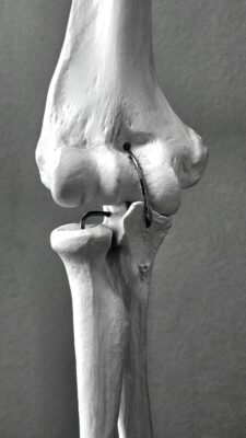 A detailed black and white view of the human knee joint anatomical model showcasing bone and ligament structures.
